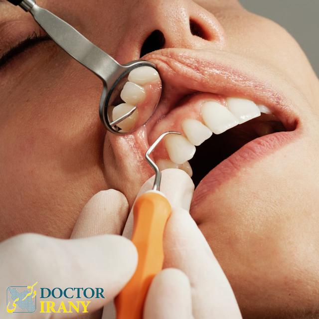 تاثیر داروهای رقیق کننده خون در دندانپزشکی