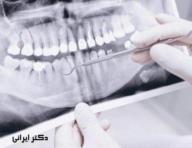 کاربرد عکس opg در دندان پزشکی